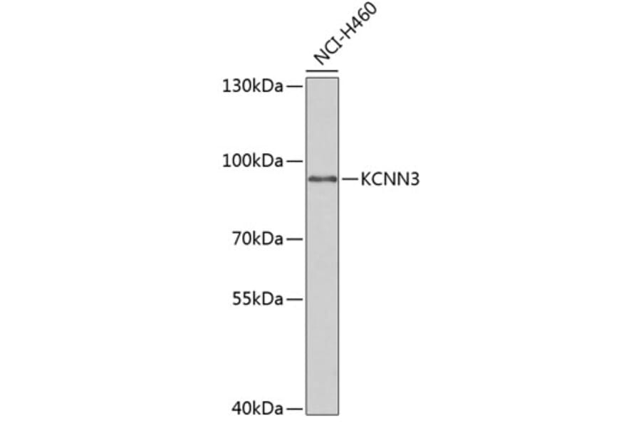 Western Blot - Anti-KCNN3 / SK3 Antibody (A15077) - Antibodies.com