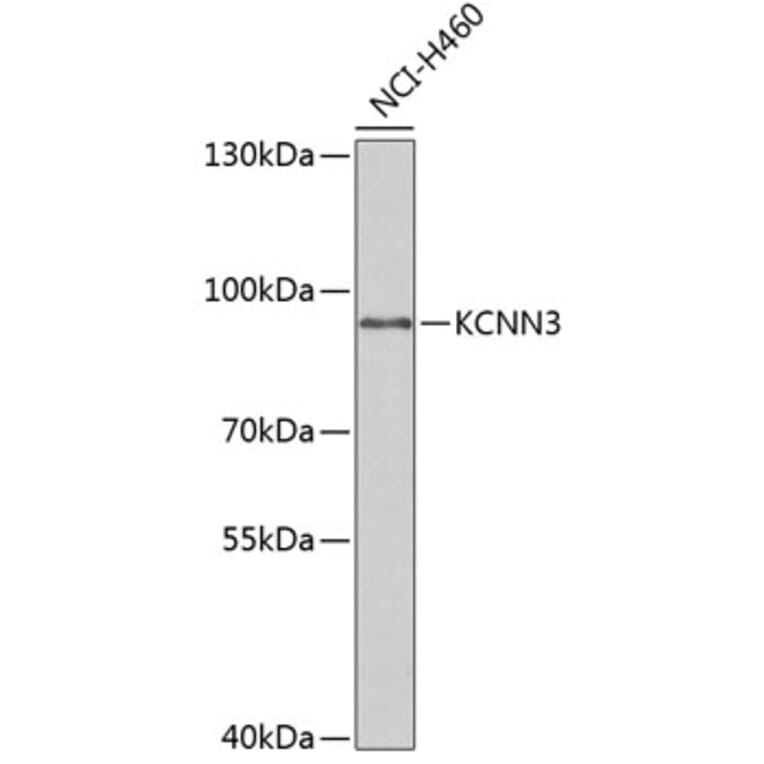 Western Blot - Anti-KCNN3 / SK3 Antibody (A15077) - Antibodies.com