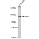 Western Blot - Anti-KCNN3 / SK3 Antibody (A15077) - Antibodies.com