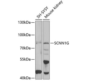 Western Blot - Anti-SCNN1G Antibody (A15078) - Antibodies.com