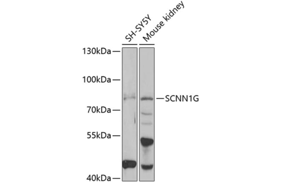 Western Blot - Anti-SCNN1G Antibody (A15078) - Antibodies.com