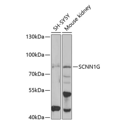 Western Blot - Anti-SCNN1G Antibody (A15078) - Antibodies.com