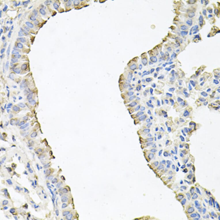 Immunohistochemistry - Anti-SCNN1G Antibody (A15078) - Antibodies.com