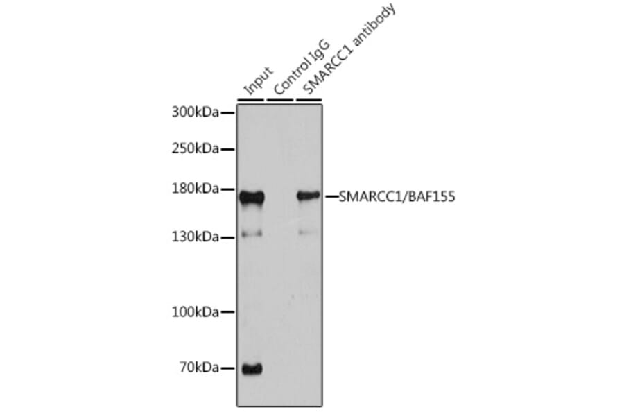 Western Blot - Anti-SMARCC1/BAF155 Antibody (A15079) - Antibodies.com