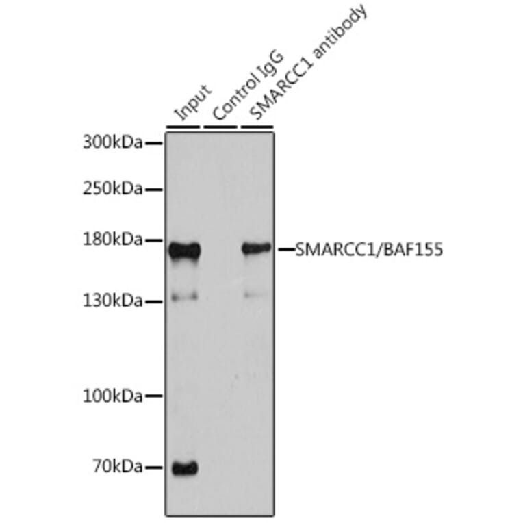 Western Blot - Anti-SMARCC1/BAF155 Antibody (A15079) - Antibodies.com