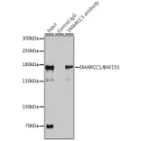 Western Blot - Anti-SMARCC1/BAF155 Antibody (A15079) - Antibodies.com