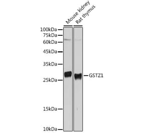 Western Blot - Anti-GSTZ1 Antibody (A15080) - Antibodies.com
