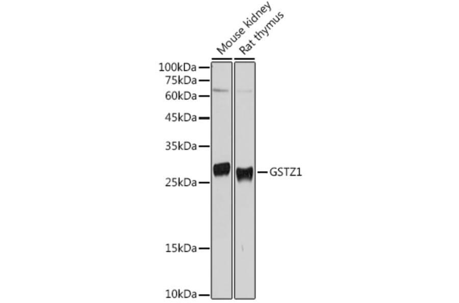 Western Blot - Anti-GSTZ1 Antibody (A15080) - Antibodies.com