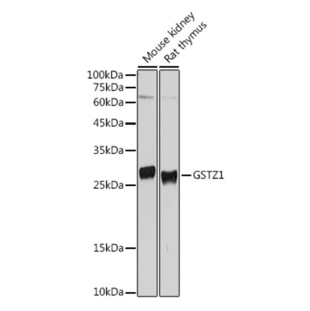 Western Blot - Anti-GSTZ1 Antibody (A15080) - Antibodies.com