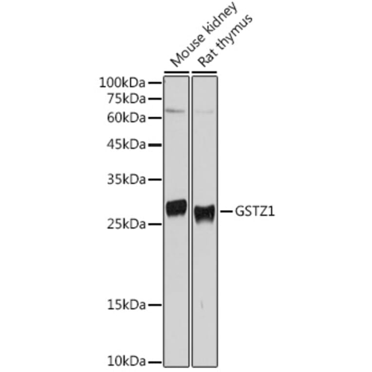 Western Blot - Anti-GSTZ1 Antibody (A15080) - Antibodies.com