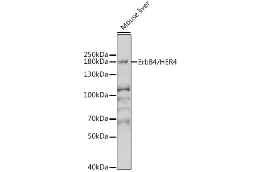 Western Blot - Anti-ErbB4/HER4 Antibody (A15081) - Antibodies.com