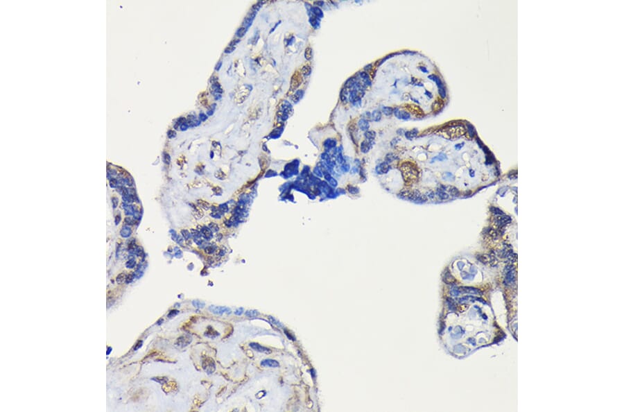 Immunohistochemistry - Anti-ErbB4/HER4 Antibody (A15081) - Antibodies.com