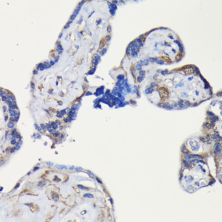 Immunohistochemistry - Anti-ErbB4/HER4 Antibody (A15081) - Antibodies.com
