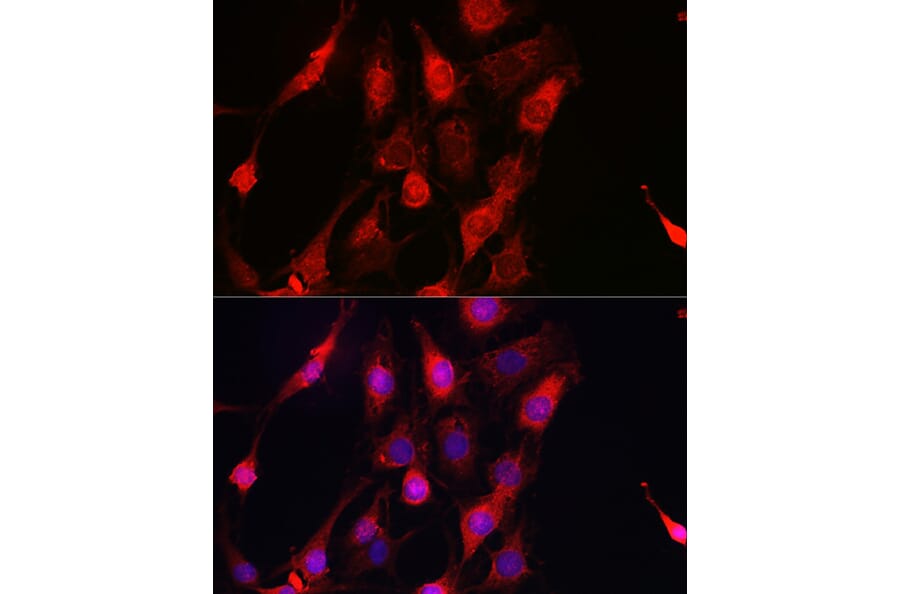 Immunofluorescence - Anti-ErbB4/HER4 Antibody (A15081) - Antibodies.com