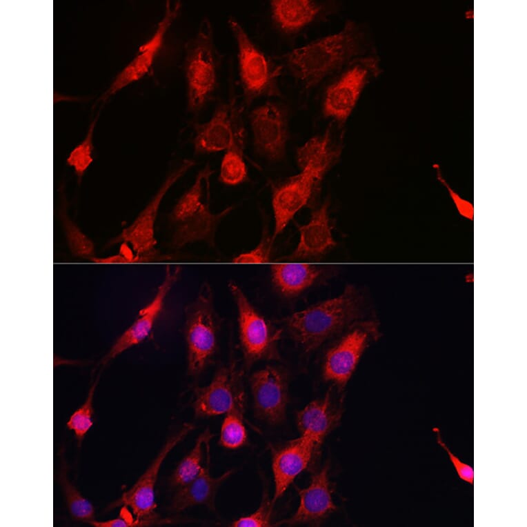 Immunofluorescence - Anti-ErbB4/HER4 Antibody (A15081) - Antibodies.com