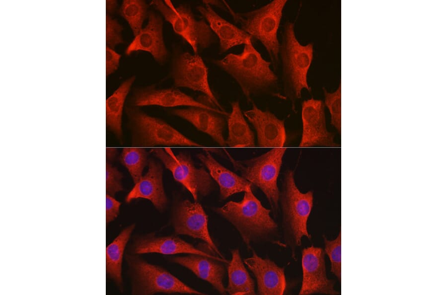 Immunofluorescence - Anti-ErbB4/HER4 Antibody (A15081) - Antibodies.com