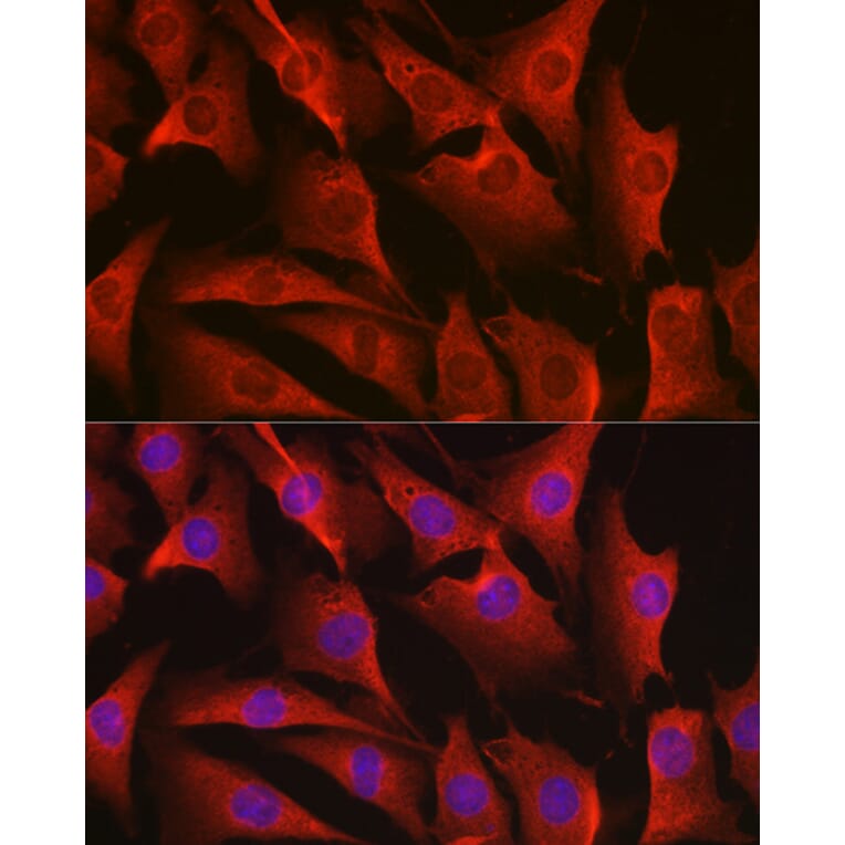 Immunofluorescence - Anti-ErbB4/HER4 Antibody (A15081) - Antibodies.com