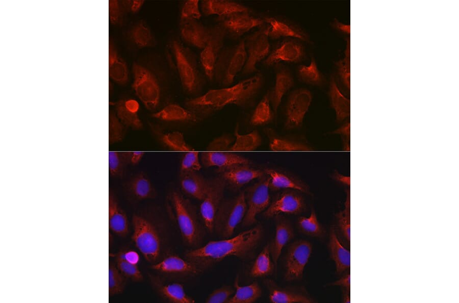 Immunofluorescence - Anti-ErbB4/HER4 Antibody (A15081) - Antibodies.com