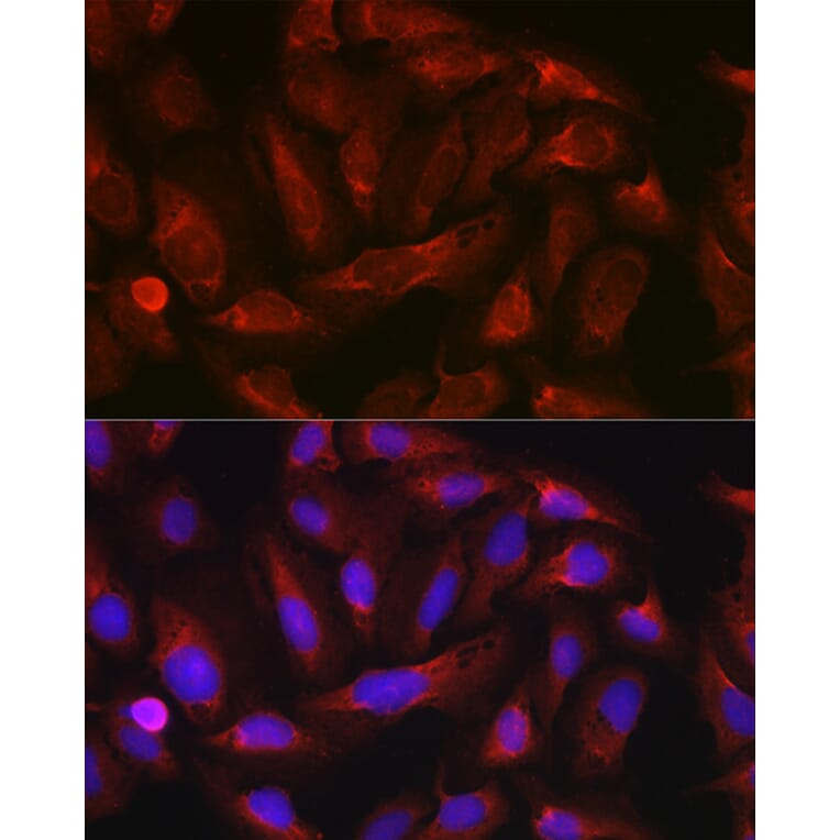 Immunofluorescence - Anti-ErbB4/HER4 Antibody (A15081) - Antibodies.com