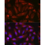 Immunofluorescence - Anti-ErbB4/HER4 Antibody (A15081) - Antibodies.com