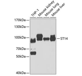 Western Blot - Anti-ST14 Antibody (A15083) - Antibodies.com