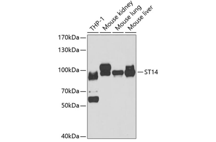 Western Blot - Anti-ST14 Antibody (A15083) - Antibodies.com