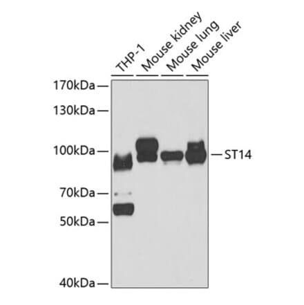 Western Blot - Anti-ST14 Antibody (A15083) - Antibodies.com