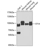 Western Blot - Anti-ST14 Antibody (A15083) - Antibodies.com