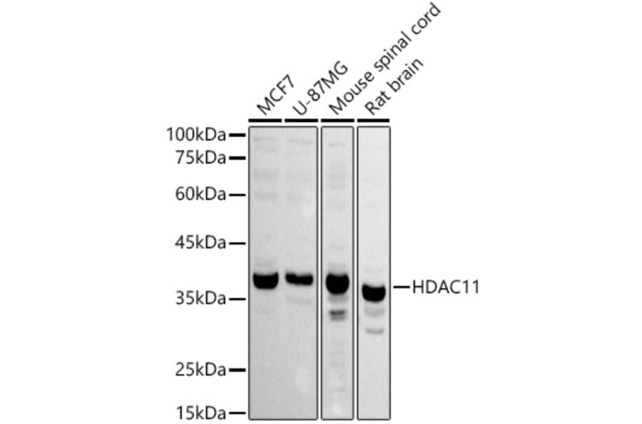 Western Blot - Anti-HDAC11/HD11 Antibody (A15084) - Antibodies.com