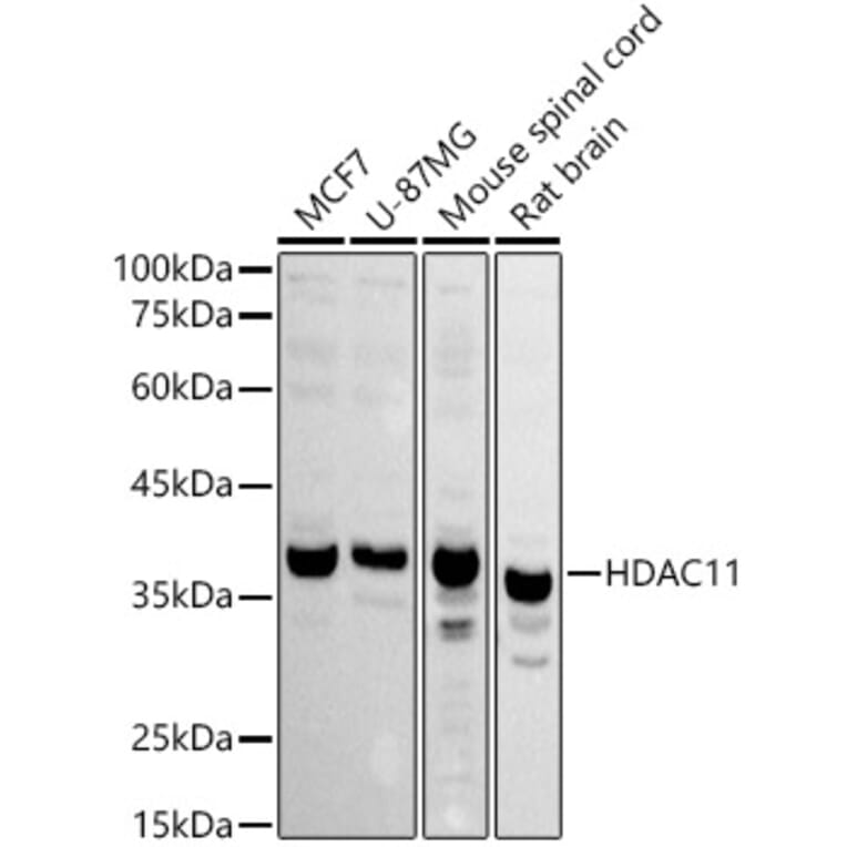 Western Blot - Anti-HDAC11/HD11 Antibody (A15084) - Antibodies.com