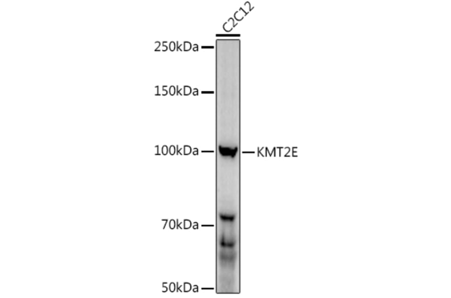 Western Blot - Anti-MLL5 Antibody (A15085) - Antibodies.com