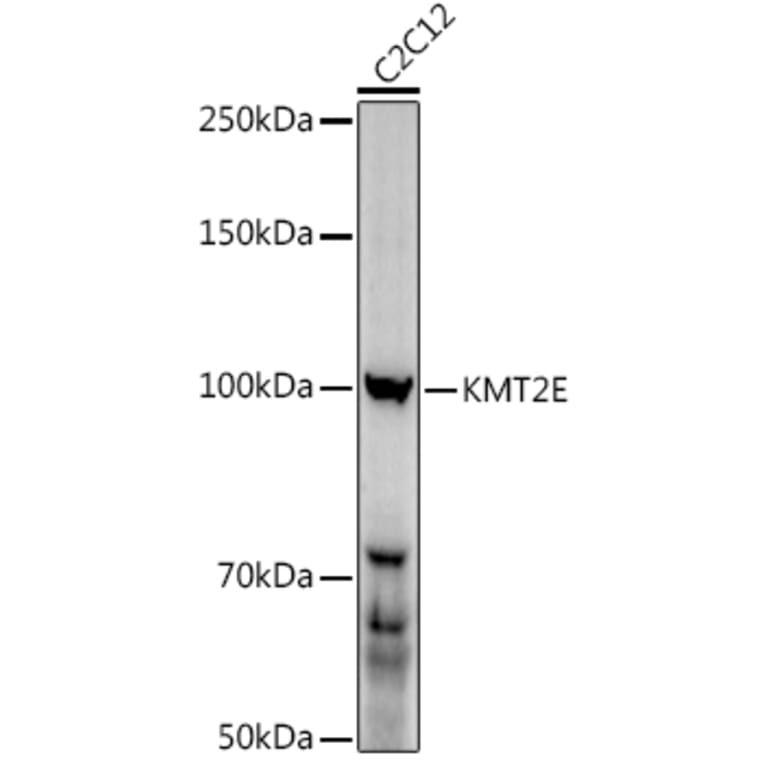 Western Blot - Anti-MLL5 Antibody (A15085) - Antibodies.com