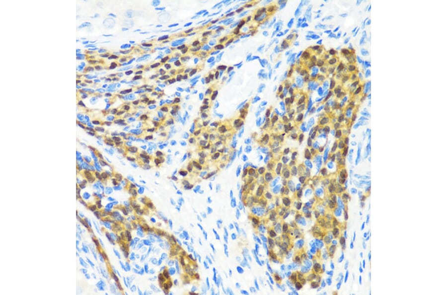 Immunohistochemistry - Anti-MLL5 Antibody (A15085) - Antibodies.com