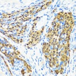 Immunohistochemistry - Anti-MLL5 Antibody (A15085) - Antibodies.com