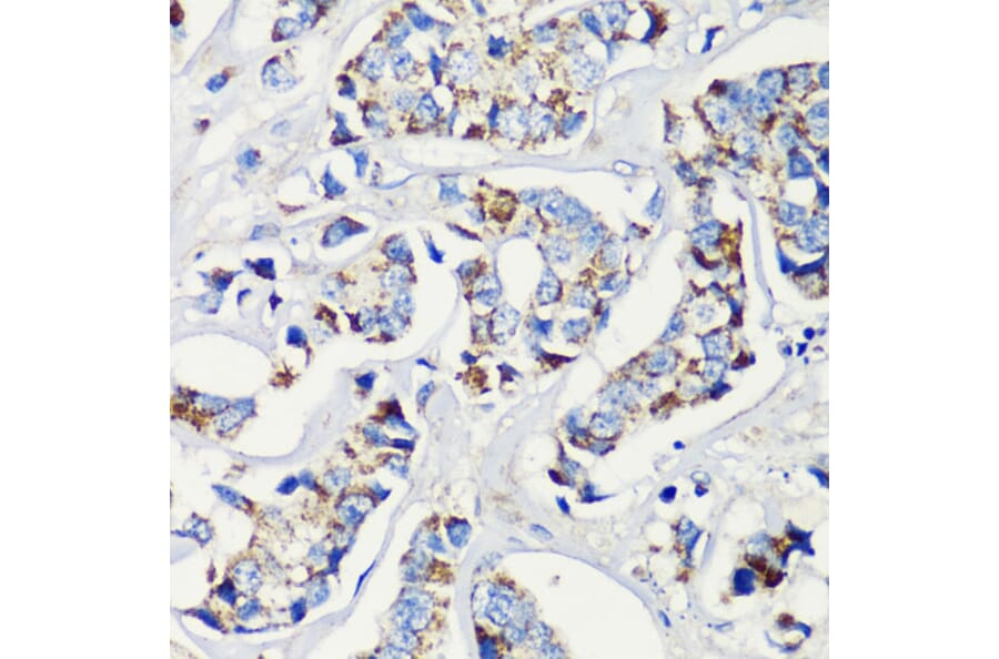 Immunohistochemistry - Anti-MLL5 Antibody (A15085) - Antibodies.com