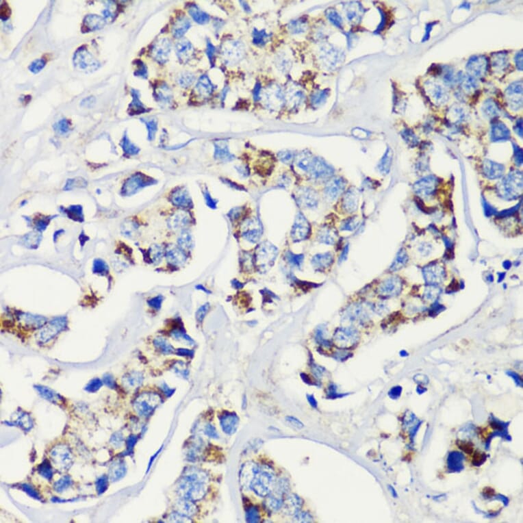 Immunohistochemistry - Anti-MLL5 Antibody (A15085) - Antibodies.com