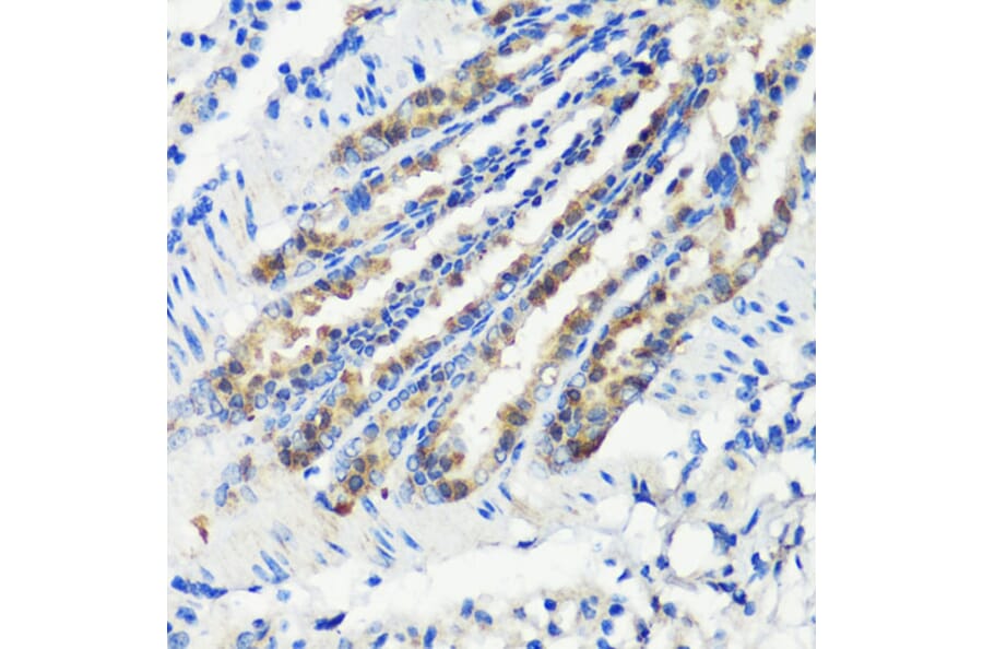 Immunohistochemistry - Anti-MLL5 Antibody (A15085) - Antibodies.com