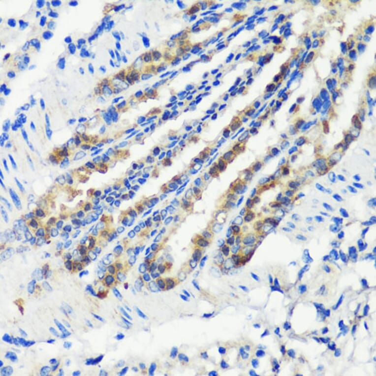 Immunohistochemistry - Anti-MLL5 Antibody (A15085) - Antibodies.com