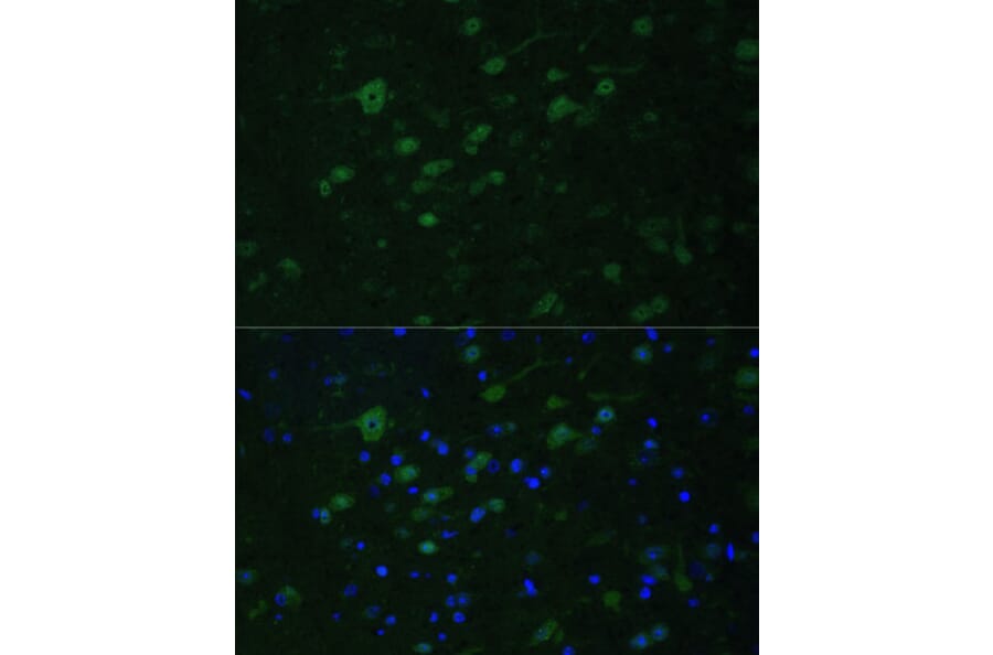 Immunofluorescence - Anti-MLL5 Antibody (A15085) - Antibodies.com