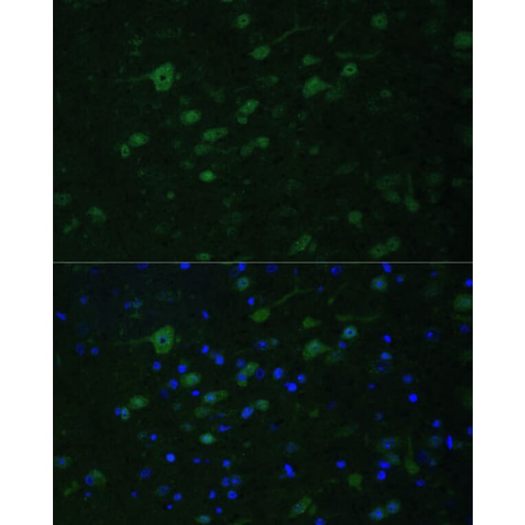 Immunofluorescence - Anti-MLL5 Antibody (A15085) - Antibodies.com