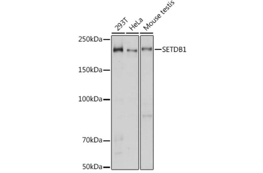 Western Blot - Anti-KMT1E/SETDB1 Antibody (A15086) - Antibodies.com