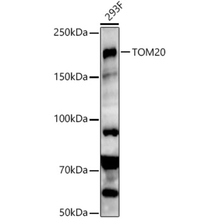 Western Blot - Anti-KMT1E/SETDB1 Antibody (A15086) - Antibodies.com