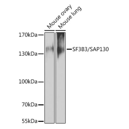 Western Blot - Anti-SF3B3 Antibody (A15087) - Antibodies.com
