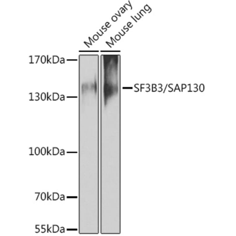 Western Blot - Anti-SF3B3 Antibody (A15087) - Antibodies.com