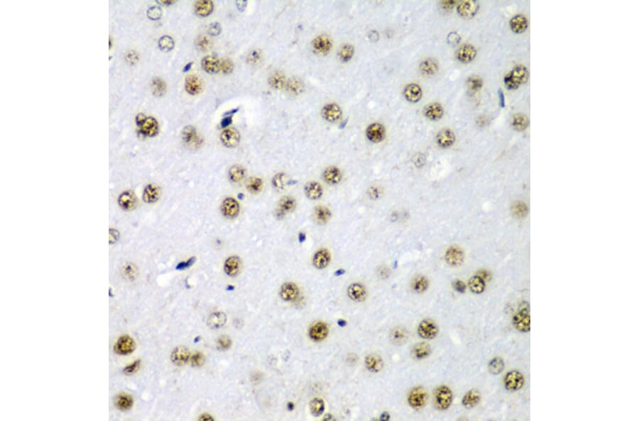 Immunohistochemistry - Anti-SF3B3 Antibody (A15087) - Antibodies.com