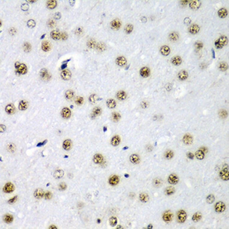 Immunohistochemistry - Anti-SF3B3 Antibody (A15087) - Antibodies.com