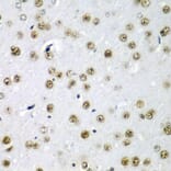 Immunohistochemistry - Anti-SF3B3 Antibody (A15087) - Antibodies.com