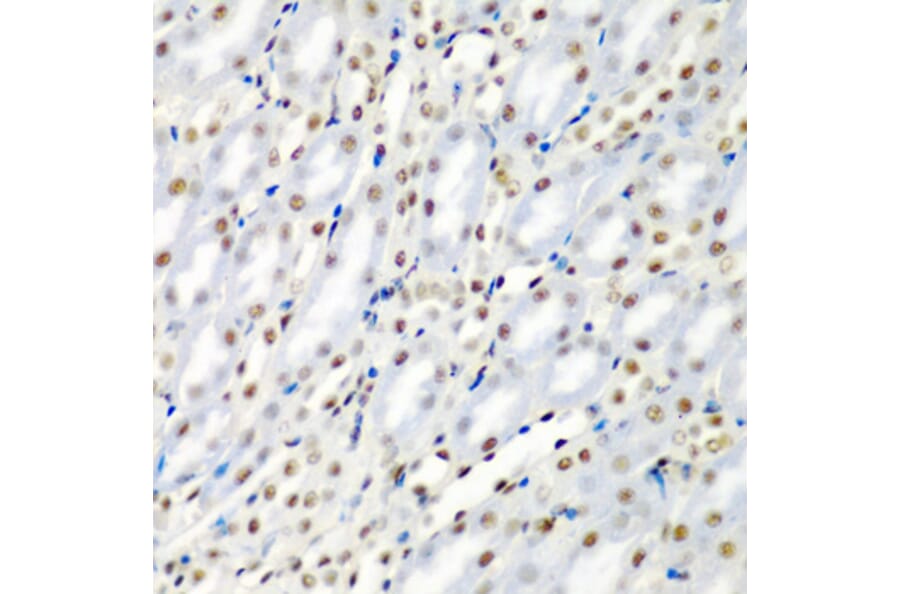 Immunohistochemistry - Anti-SF3B3 Antibody (A15087) - Antibodies.com