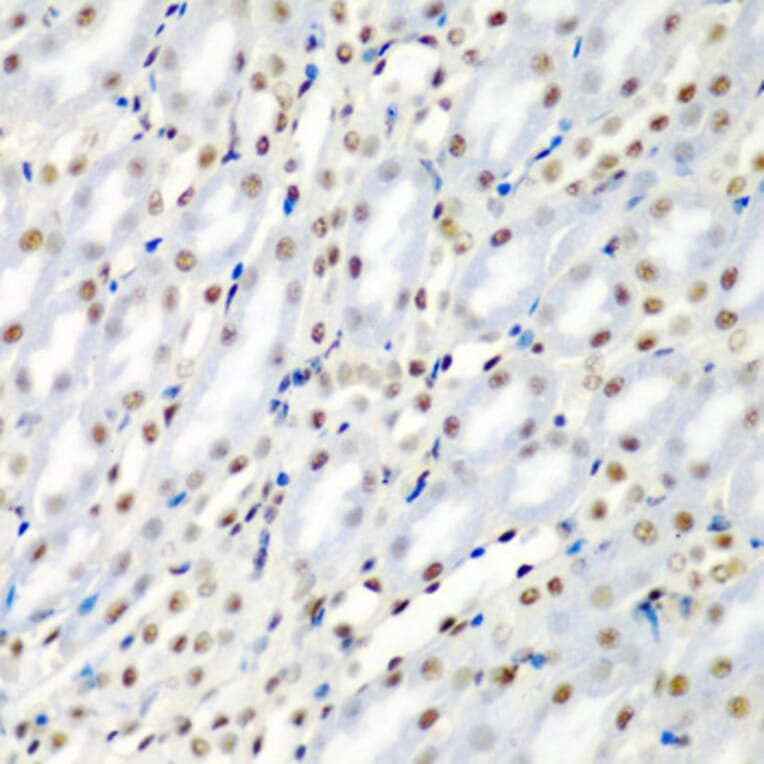 Immunohistochemistry - Anti-SF3B3 Antibody (A15087) - Antibodies.com