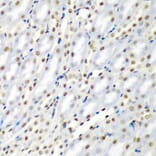 Immunohistochemistry - Anti-SF3B3 Antibody (A15087) - Antibodies.com